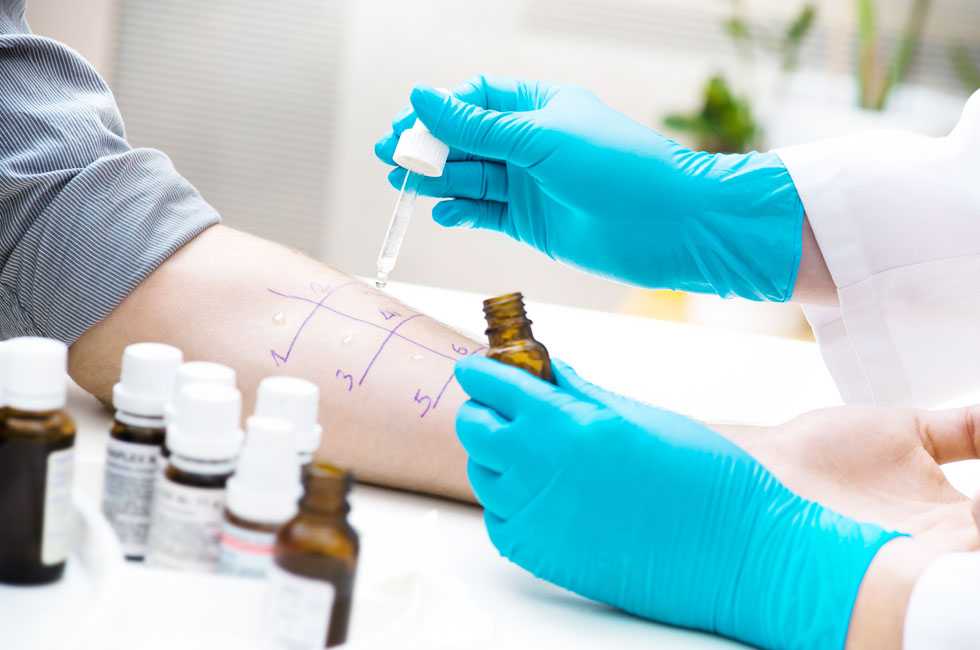 alergia_alergista_em_jau_rede_vik