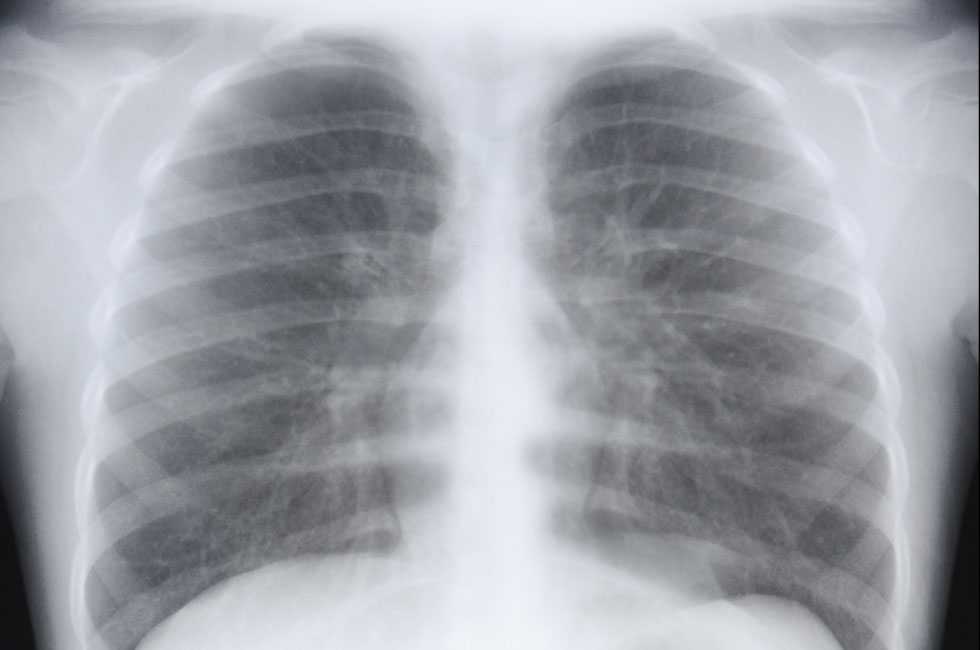 medico_pneumologista_jau